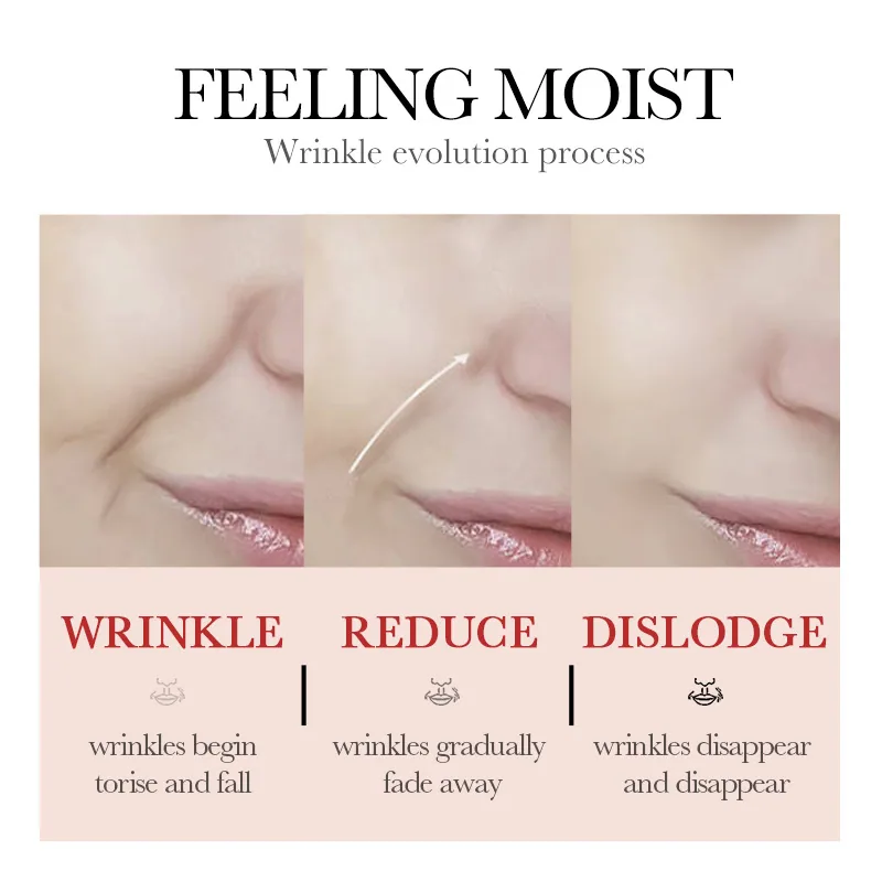 SADOER collagen gel nasolabial fold removal stickers close-up, hydrating gel texture for fine lines at mouth corners